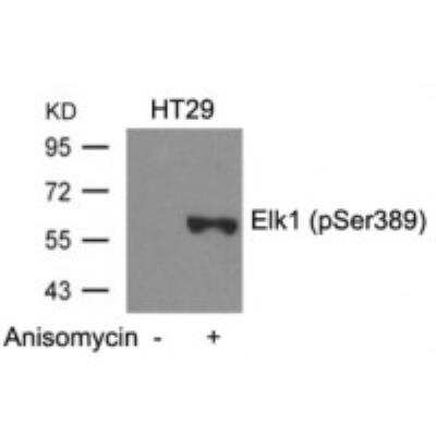 Western Blot: Elk1 [p Ser389] Antibody [NBP2-54759] - Western blot analysis of lysed extracts from HT29 cells untreated or treated with Anisomycin using Elk1 [p-Ser389]